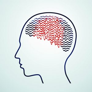Drawing of brainwaves during Epilepsy 